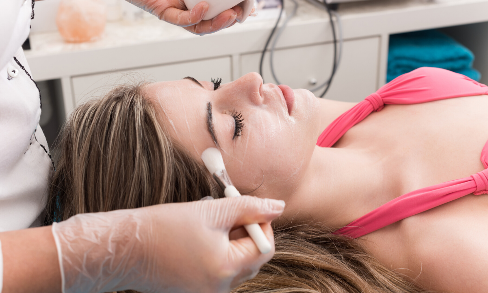 chemical peels arlington