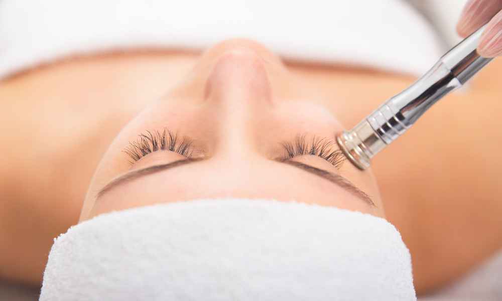 microdermabrasion arlington