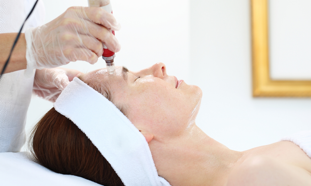 microneedling arlington