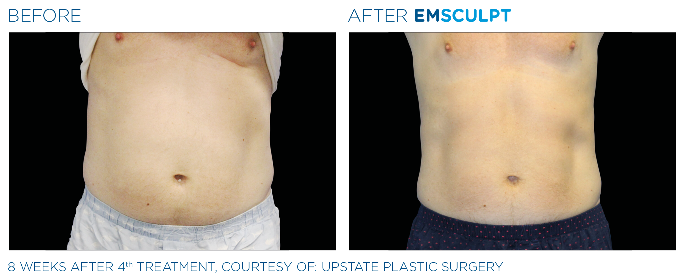 body sculpting northern virginia
