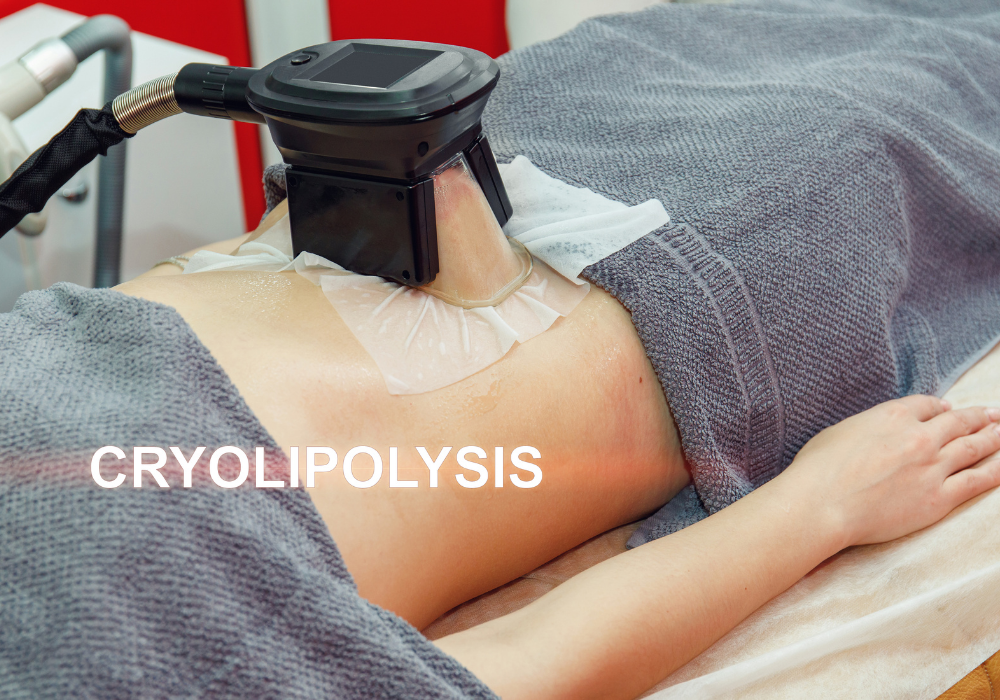 Cryoskin Body Sculpting, Sculpt