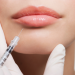 lip filler cost arlington