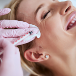 botox for crow's feet