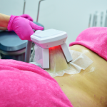 coolsculpting arlington va