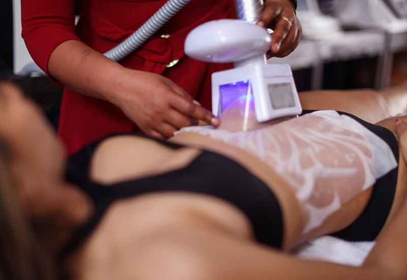 Cryoskin Body Sculpting, Sculpt