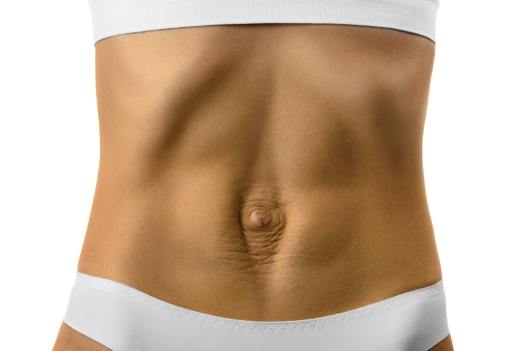 Deep Aesthetics - The Emsculpt NEO : For Diastasis Recti + Other Ab  Separation Treatments 🤩🤩🤩 Reconstriuctive surgery, physical therapy, and  Emsculpt NEO for diastasis recti are all effective treatments for abdominal