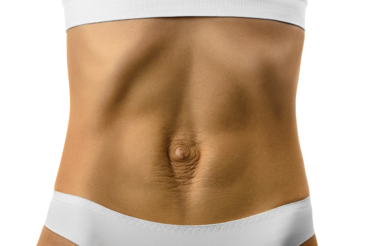 How EmSculpt NEO can help improve Diastasis Recti