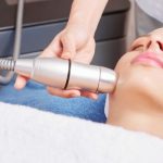 IPL dark spot removal arlington