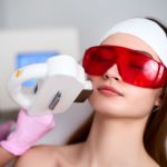 IPL photofacial Arlington