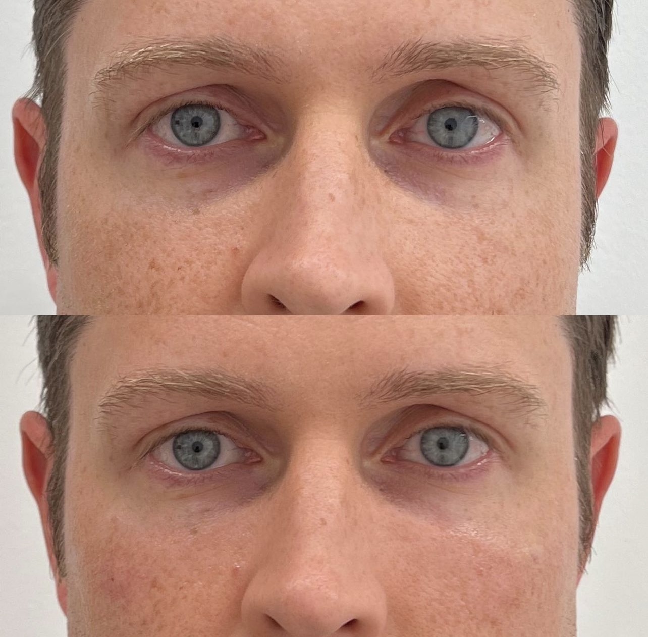 AntiAging Elite Body Contouring in Northern Virginia Ultra Body Sculpt