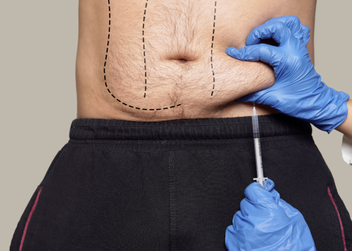 The Benefits of Weight Loss Injections Near Alexandria