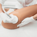 best cellulite removal specialist in Northern VA