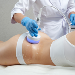 body sculpting services Arlington