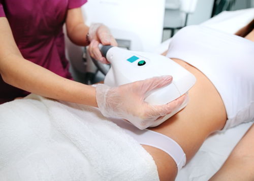 Is Achieving Your Body Goals With CoolSculpting in Chantilly Possible?