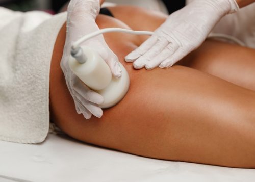 How Much Does Cellulite Treatment Cost in Northern Virginia?
