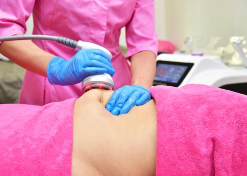 What Cellulite Treatments in Alexandria and Shirlington Actually Work?