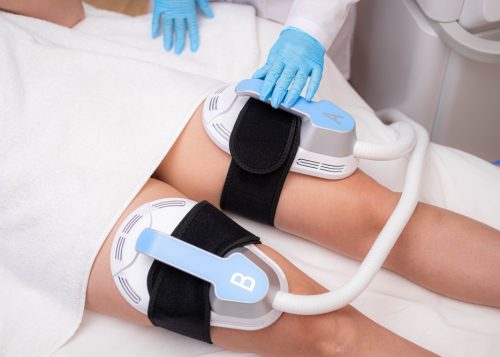Who Does Emsculpt Near Me in Arlington, VA?