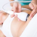 woman getting nonsurgical body sculpting near DC