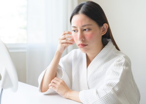 A Day-by-Day Guide to Recovery After CoolPeel Laser Treatment Near DC