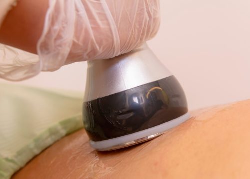 Why You Should Try Nonsurgical Skin Tightening Near Annandale, Virginia