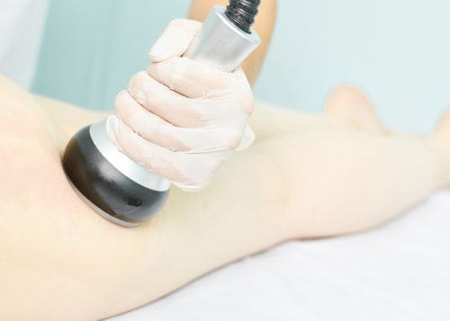 Skip the Scalpel: A Guide to Laser Lipolysis in Arlington, VA