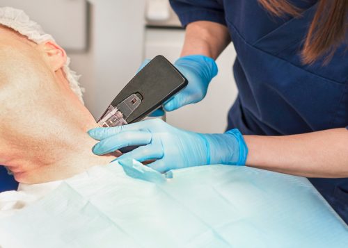 Morpheus8 for Neck Sagging: Skin Tightening in Arlington County, VA