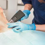Morpheus8 skin tightening near Alexandria VA