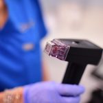 Morpheus8 can tighten sagging skin without surgery