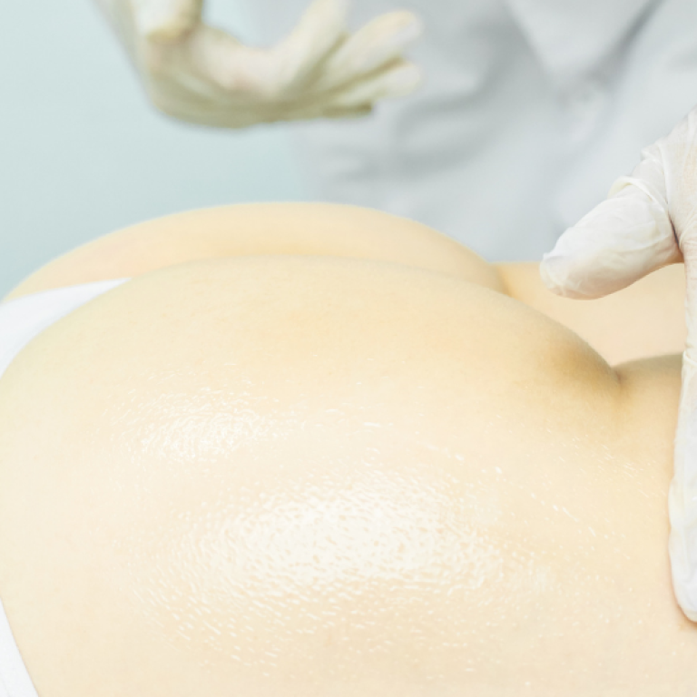 best non-surgical butt lift arlington