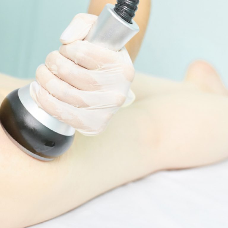 laser lipolysis Arlington