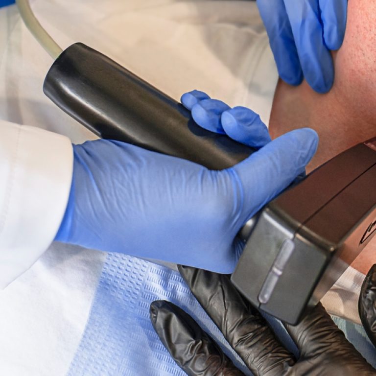 morpheus8 non-surgical treatment for skin laxity